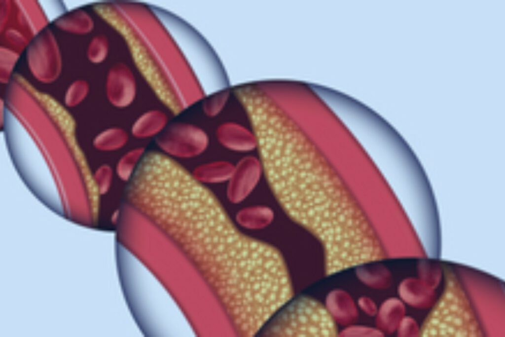 Elerio Programs - 316px x 83px (312 × 146px) - 4